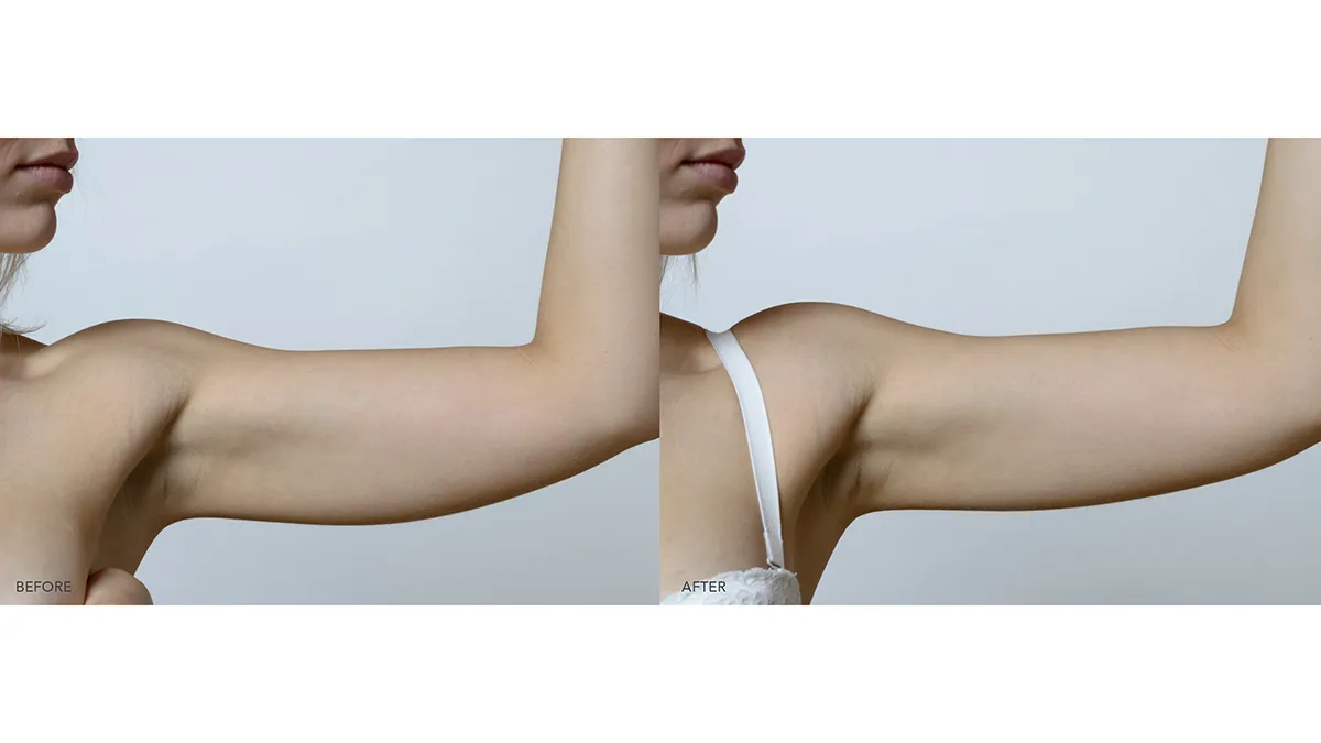 Firming Body Lotion before and after