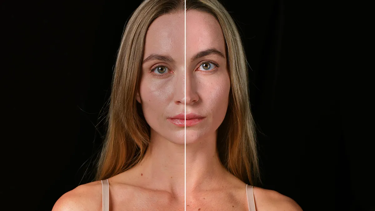 FAQ 402 before and after