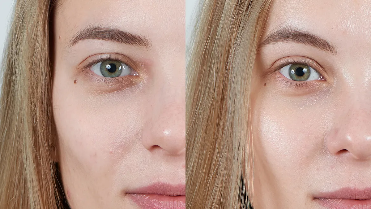 UFO LED Lighthouse Red Light Panel before after