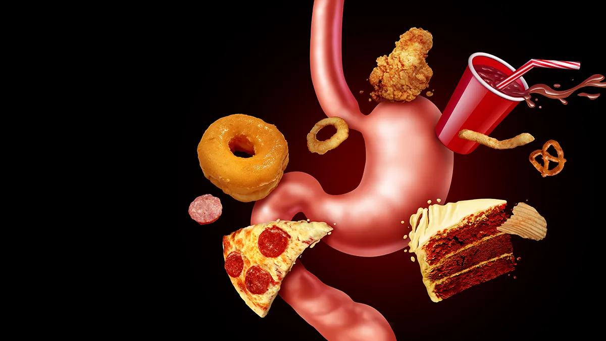 A drawing of a stomack and fast food surrounding it that causes bloating