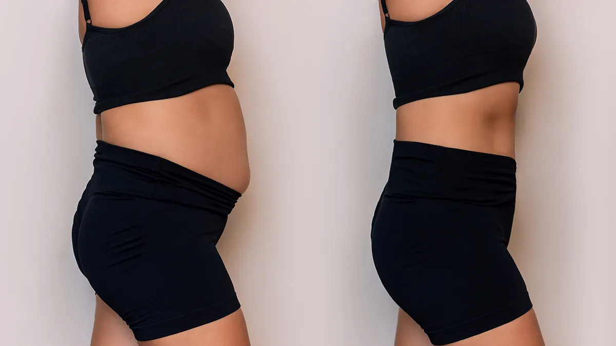 A woman that figured ut how to get rid of bloating