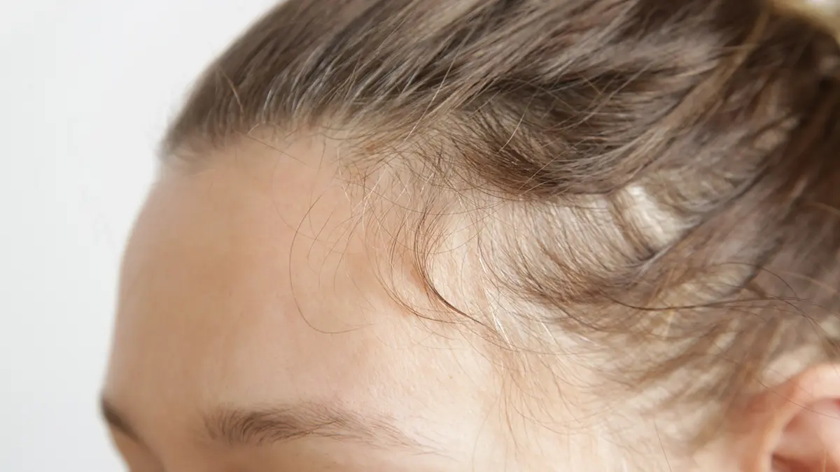 Close up glp 1 side effects hair loss