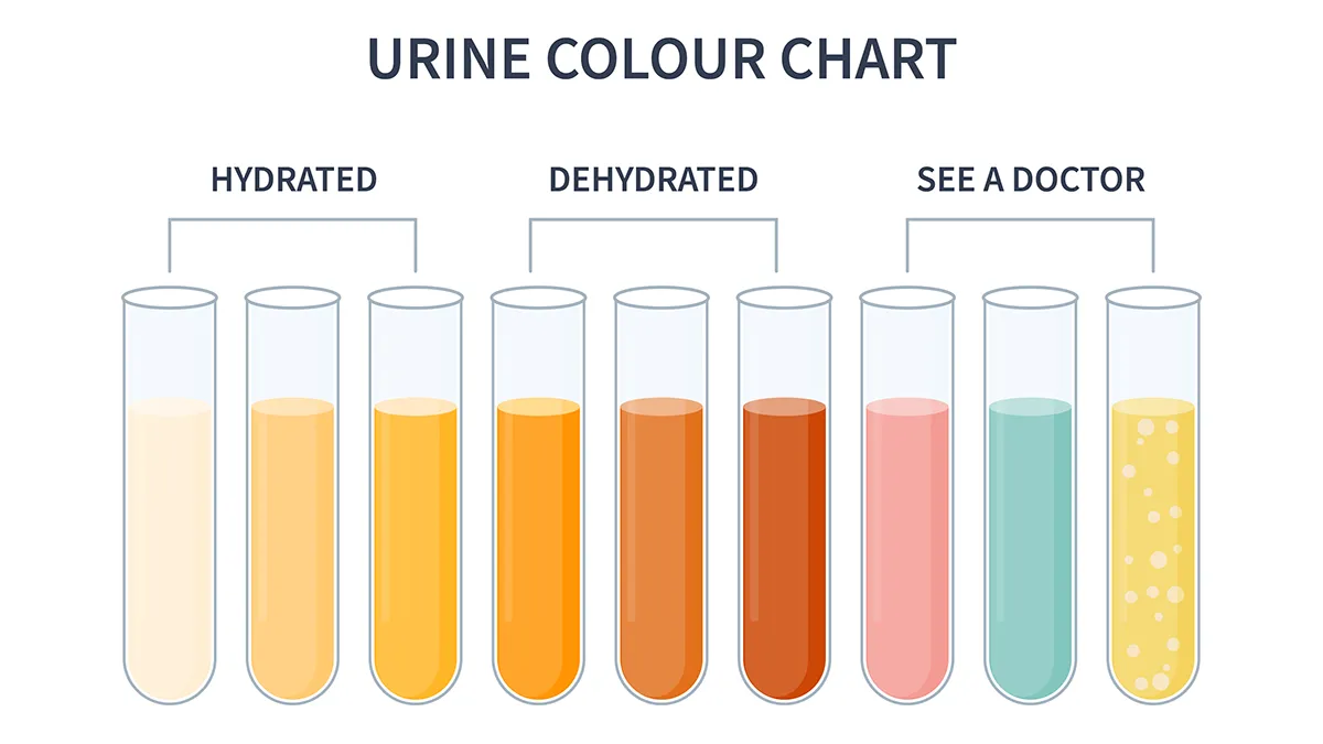 pee color chart for inadequate hydration