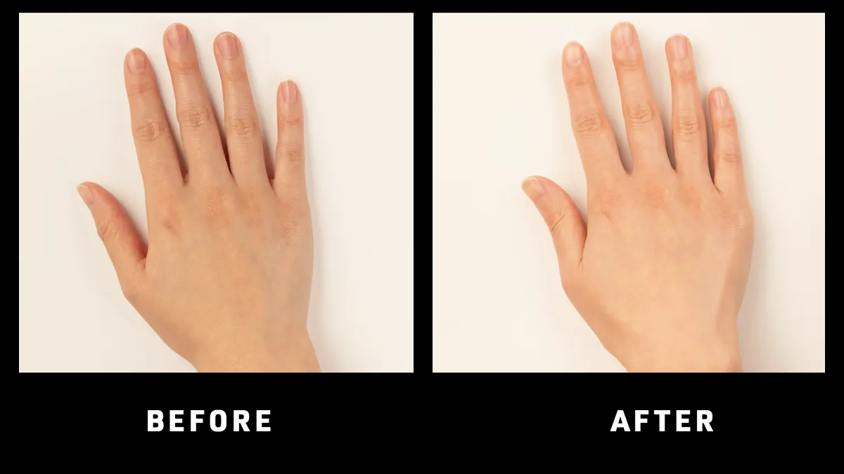 FAQ 221 before and after red LED therapy for hand aging