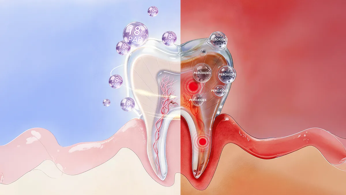 peroxide vs PAP teeth whitening tooth cross section