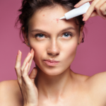 peeling químico