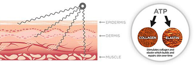 facial microcurrents