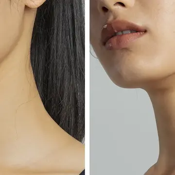 A woman's jawline before and after microcurrent showing if microcurrent works 