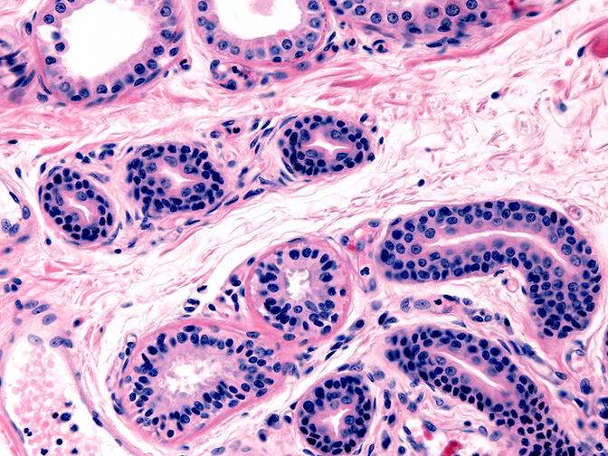 Microscopic view of secretory units of apocrine and eccrine sweat glands