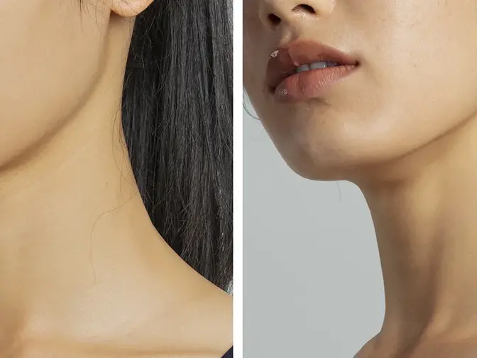 A woman's jawline before and after microcurrent showing if microcurrent works 