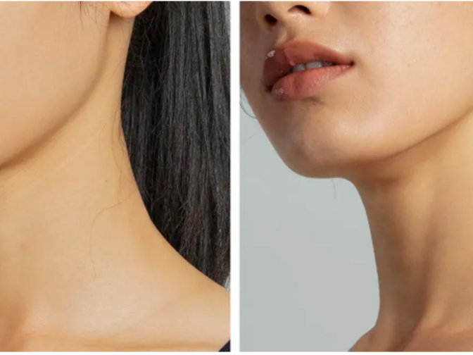 microcorrientes lifting facial