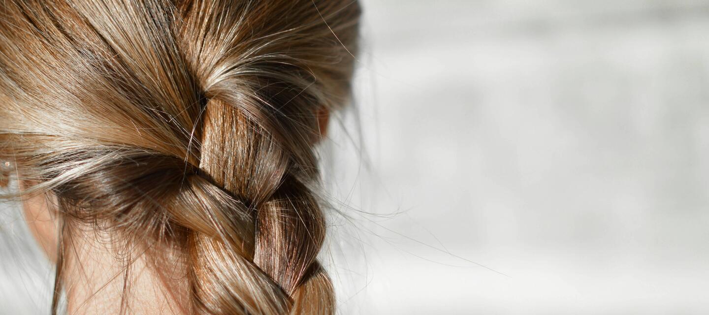 alopecia alopecia