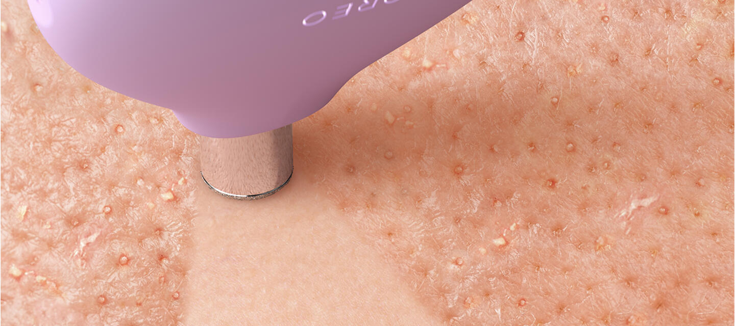 FOREO KIWI™ and KIWI™ derma User Reviews | FOREO