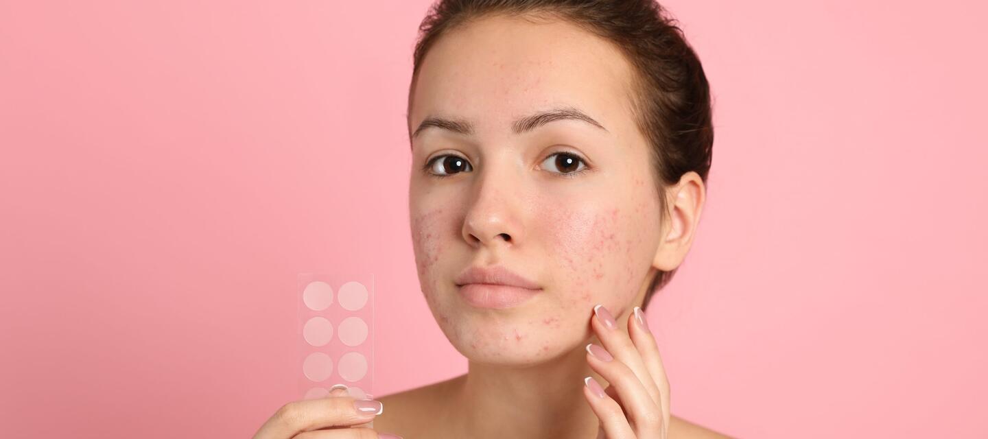 acne acne