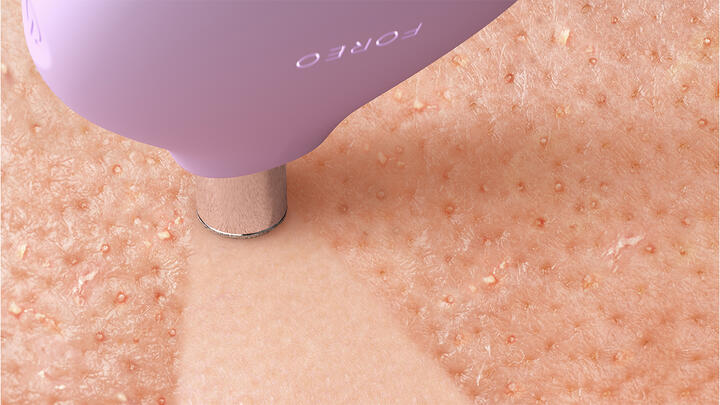 FOREO KIWI pore suction device vacuuming blackheads from the skin